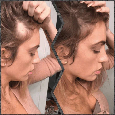 Toppik Hair Fiber - MEGA PROMO 57% OFF no KIT