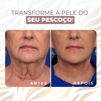 Neckfit - Adesivo para rugas