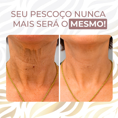 Neckfit - Adesivo para rugas